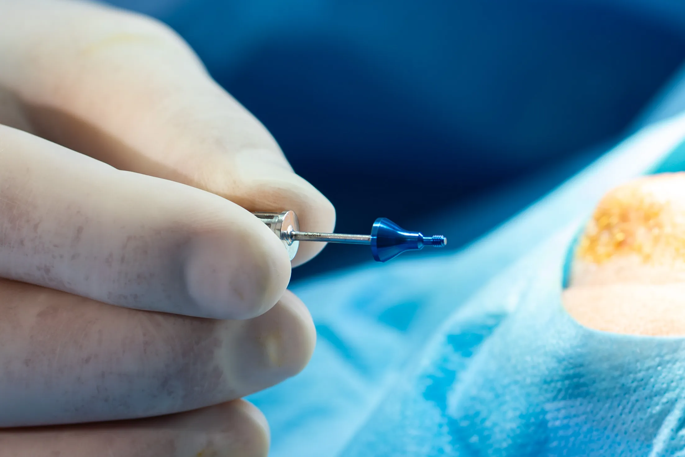Gros plan d'un implant dentaire tenu en gants stériles pendant une intervention