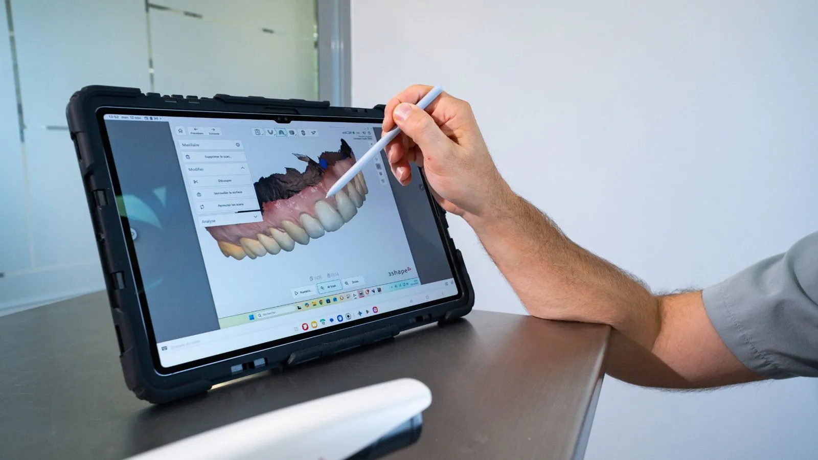 Empreinte numérique dentaire sur tablette